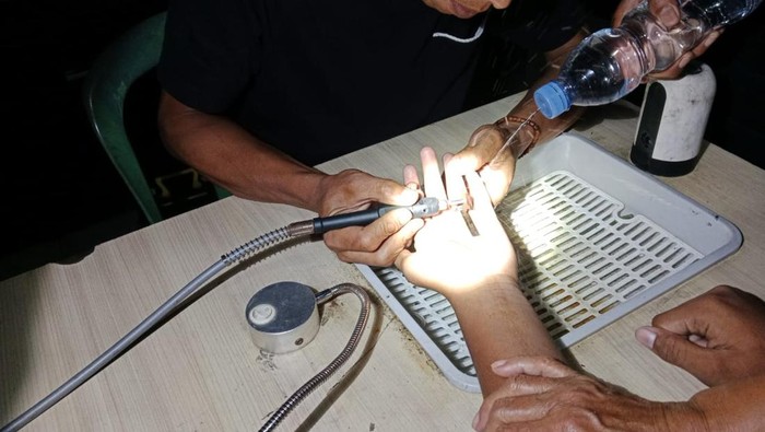 1763205447362-damkar-kuningan-saat-mencoba-melepaskan-cincin-di-jari-seorang-anak-1763178277087_169