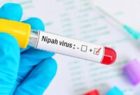 1769533488829-virus-nipah-1769497226915_169